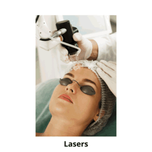 lasers